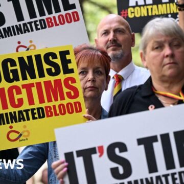 Scottish blood victims were 'studied without knowledge'