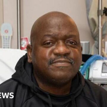 Man who received first pig kidney transplant dies