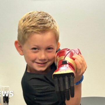 Boy, five, is world’s youngest to receive bionic hero arm
