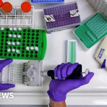 Prostate cancer hopes raised after at-home spit test trials